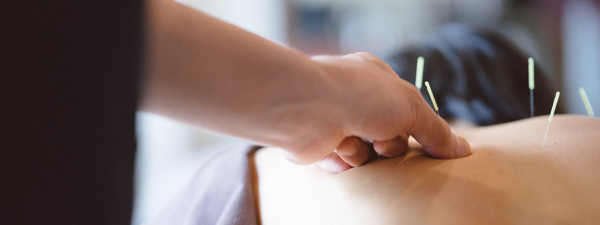 Akupunktura és a bőr egészsége – Akupunkturbehandlungen usw tanácsai