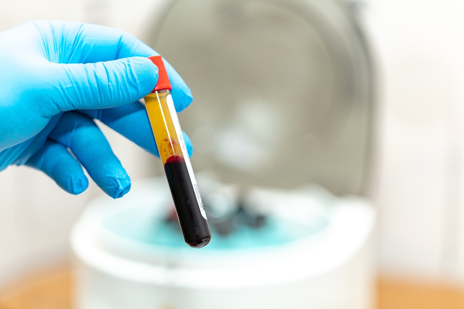 prp röhrchen – Hochwertige Produkte für Haut und Haar bei MorySkin